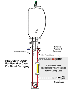 Using the Hemobag® saves whole blood not just red cells, and it takes less time to hemoconcentrate the same amount of blood than a cell washer like this could.